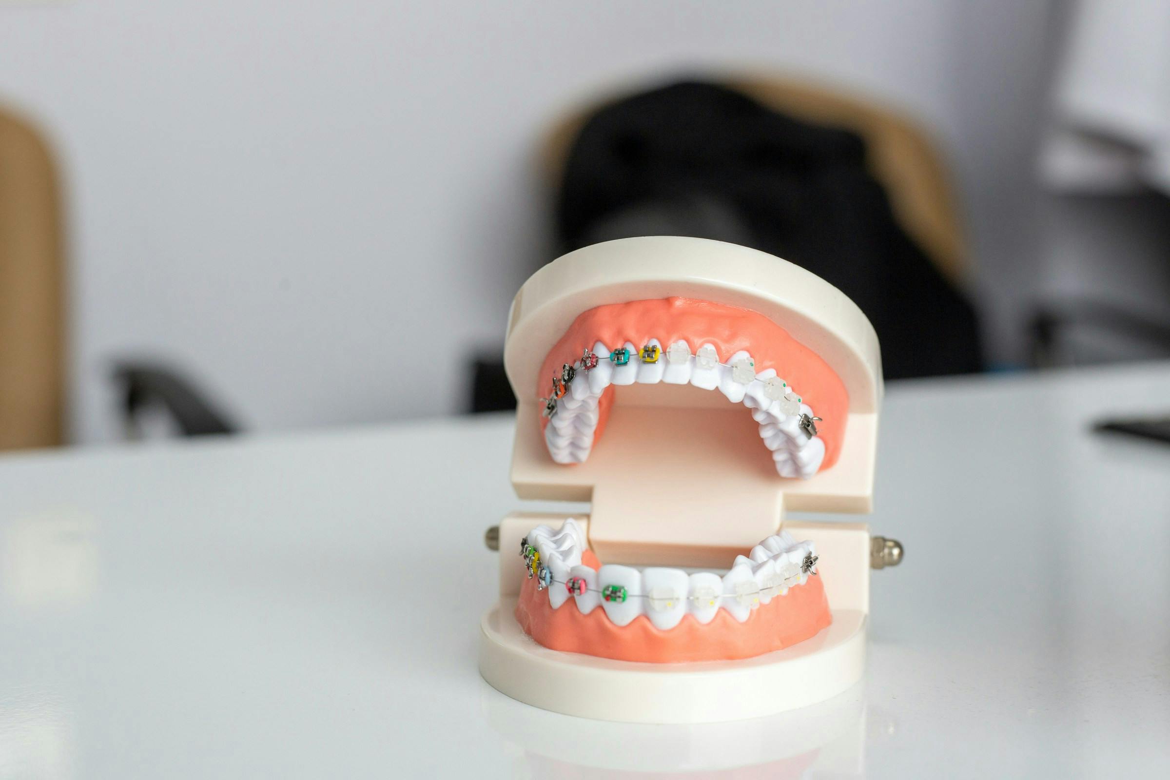 A dental model showcasing different types of braces and orthodontic issues on a desk