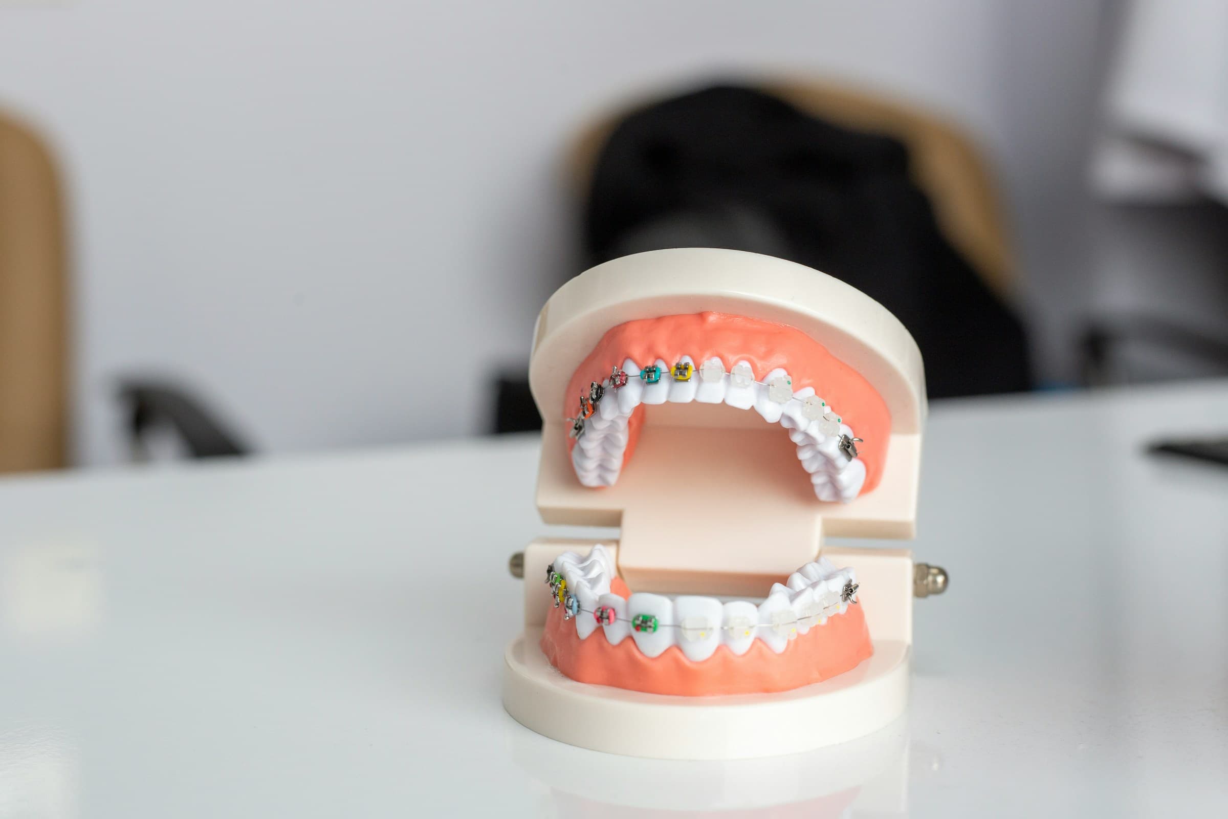 A dental model showcasing different types of braces and orthodontic issues on a desk